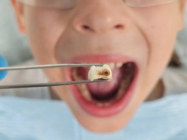 Best Tooth Pain Emergency Relief  in Delaware, OH