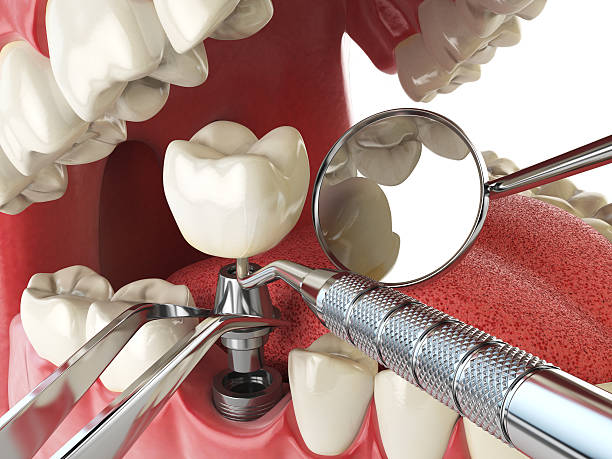 Best Cracked Tooth Emergency Dentist  in Delaware, OH