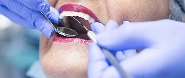 Best Dentist for Tooth Abscess  in Delaware, OH